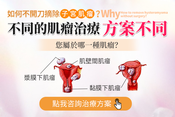 香港子宮肌瘤需要切除子宮嗎？子宮肌瘤子宮要拿掉嗎